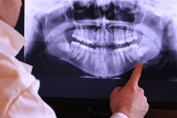 Best Emergency Dentist for Special Needs Patients in East Foothills, CA