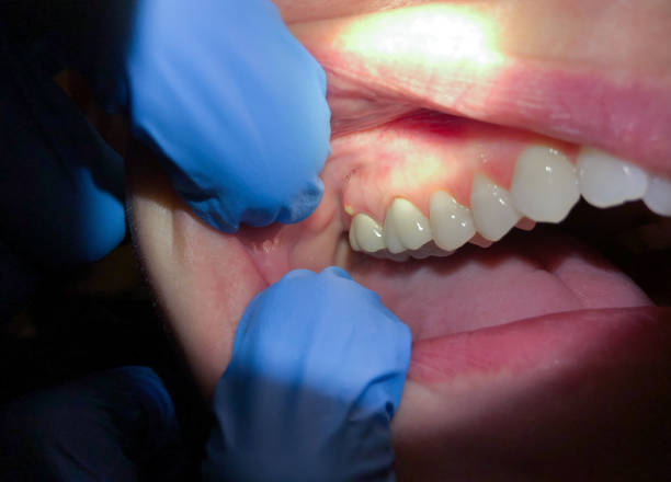 Best Orthodontic Emergency Dentist in East Foothills, CA